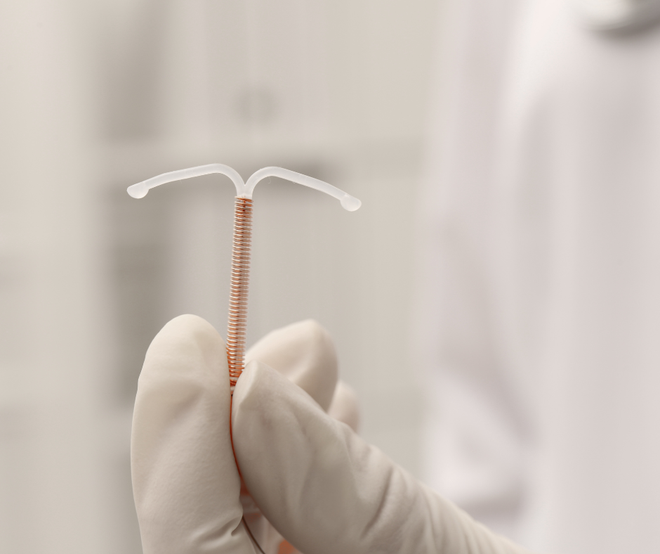 Mano con guante médico sosteniendo un dispositivo intrauterino (DIU) de cobre en forma de T.